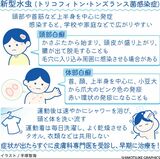 スポーツや学校で感染例もある「新型水虫」　練習後はすぐシャ…