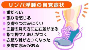 リンパ浮腫 早期治療を 腕や脚のみくみ 重だるい がん手術後の変化に注意 社会 下野新聞 Soon ニュース 下野新聞 Soon スーン